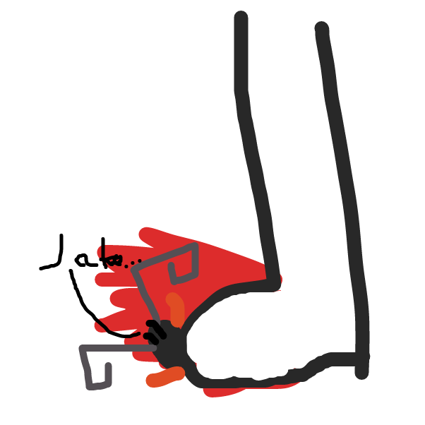 Drawing in Beetle gets squished by dytamic